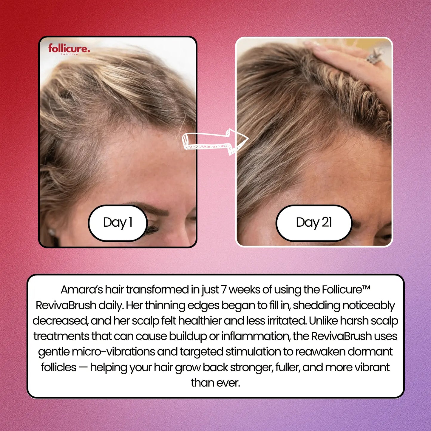 Follicure⢠RevivaBrush