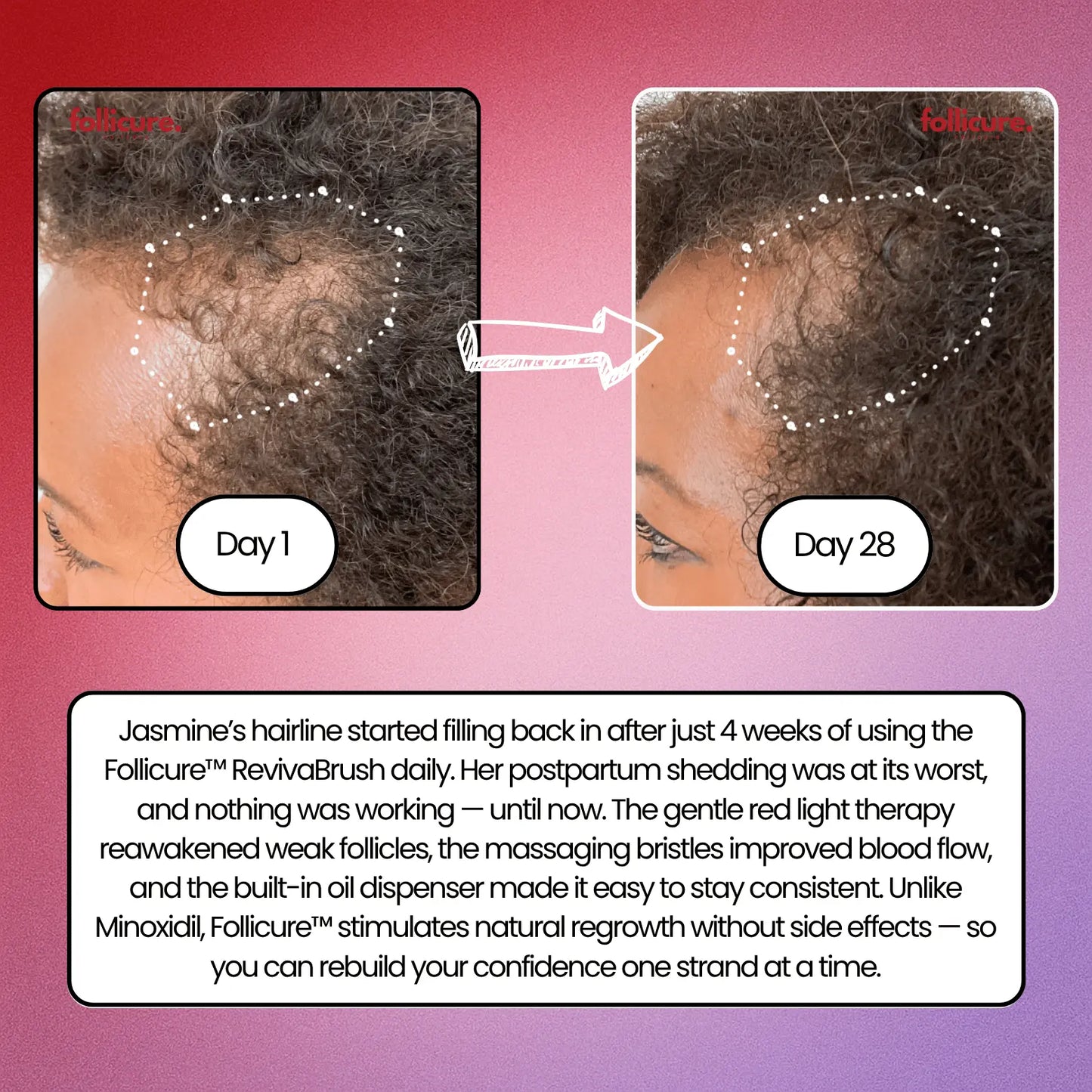 Follicure⢠RevivaBrush